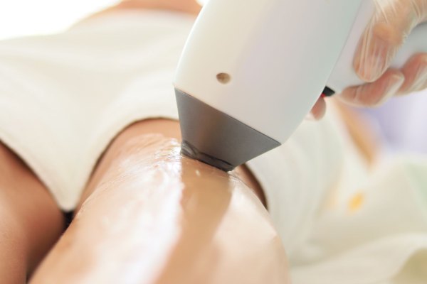 Lazer Epilasyon Öncesi ve Sonrası Yapılması Gerekenler